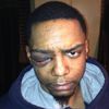 UPDATE: Five Arrested In Williamsburg Beating Of Gay Black Man